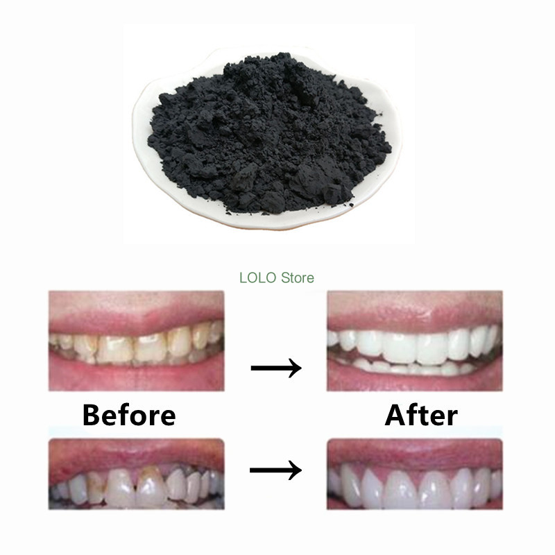 순수 숯 분말, 활성탄 분말, 식품 등급 브러시 숯 분 - Activated Charcoal Powder 리뷰 및 가격