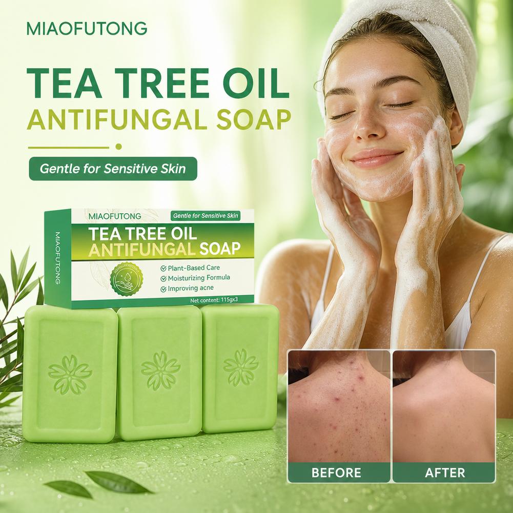 3pcs 티 트리 오일 비누 바 천연 식물 추출물 수제 - Castor Oil Soap 리뷰 및 가격