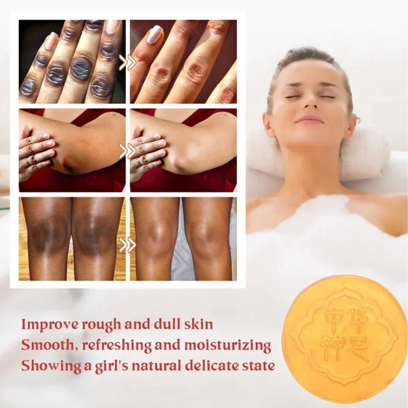 페이스 브라이트닝 바디 비누 오일 컨트롤 무릎 겨드랑이 - Castor Oil Soap 리뷰 및 가격