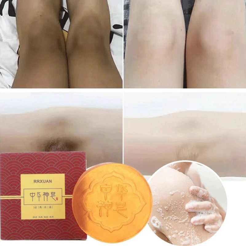 페이스 브라이트닝 바디 비누 오일 컨트롤 무릎 겨드랑이 - Castor Oil Soap 리뷰 및 가격